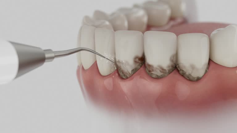 Reliable Dental contractor in Beckett Ridge, OH by Dentist Open Now